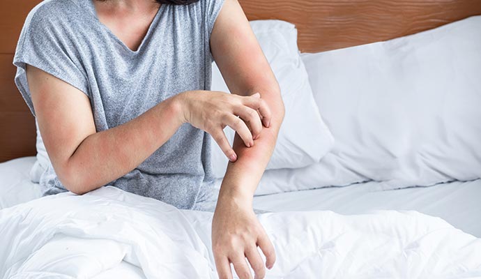 Person scratching arm due to allergen Person scratching arm due to allergen