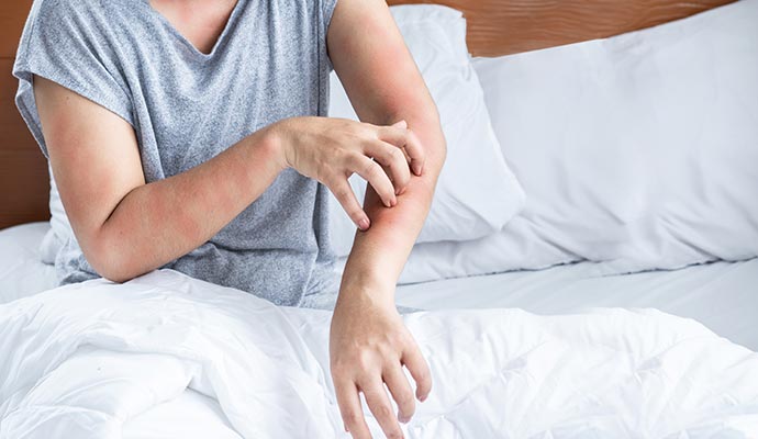 Woman having allergy effect Woman having allergy effect